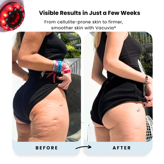 LED Lymphatic Sculpting Massager