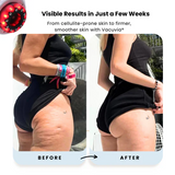 LED Lymphatic Sculpting Massager